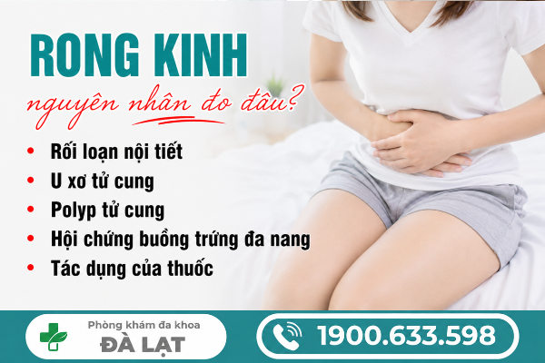 Hình ảnh minh họa